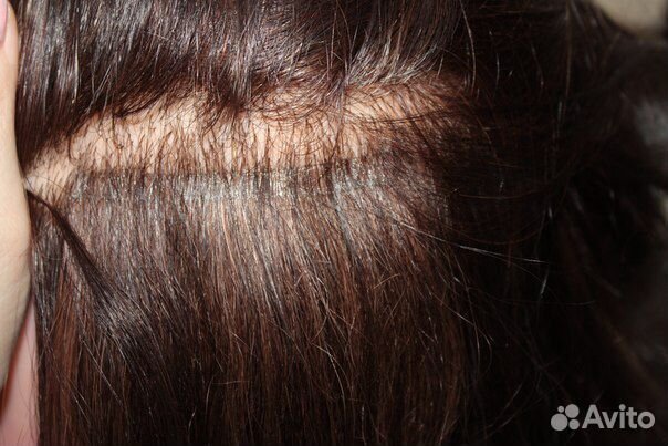 Успей на Обучение 7 Видов Наращивания Волос