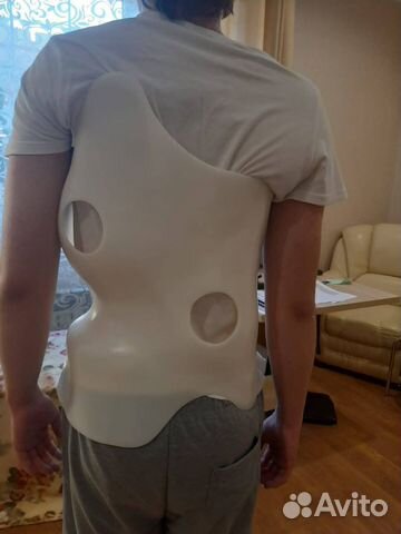 Корсет - Орто лечение сколиоза корсетом Шено